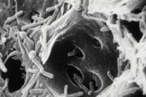 Per il Ministero delle Politiche Agricole, l’Italia è considerata indenne da Xylella fastidiosa, eccetto le province di Lecce e Brindisi. Eppure riprendono gli abbattimenti. Ma quali sono i rischi e pericoli per la vite? L’opinione di Attilio Scienza