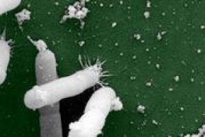 La Xylella Fastidiosa, parassita, che in Italia ha colpito soprattutto gli olivi pugliesi, è davvero un rischio per la vigna? A WineNews il parere di due esperti, Leonardo Valenti e Attilio Scienza , docenti di viticoltura dell’Università di Milano