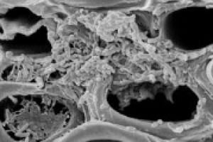 Il flagello della Xylella minaccia la vite. A WineNews Leonardo Valenti, docente di viticoltura all’Università di Milano, rassicura: “in California ha creato molti problemi, ma con la giusta attenzione si può combattere senza grossi patemi”