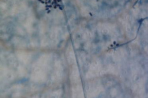 La lotta alle malattie delle vite potrebbe aver compiuto un deciso passo in avanti, grazie alla genetica: la Fondazione Edmund Mach ha decifrato il codice genetico del patogeno che provoca la peronospora (studio pubblicato su Scientific Reports)