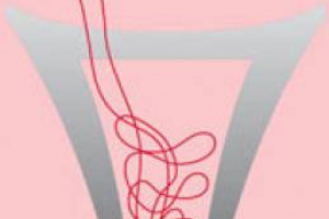 LA COMMISSIONE EUROPEA BOCCIA IL ROSATO OTTENUTO DALLA SEMPLICE MISCELA DI VINO BIANCO E VINO ROSSO. I COMMENTI DEL MINISTRO DELLE POLITICHE AGRICOLE LUCA ZAIA, FEDERDOC, COLDIRETTI, CONFAGRICOLTURA